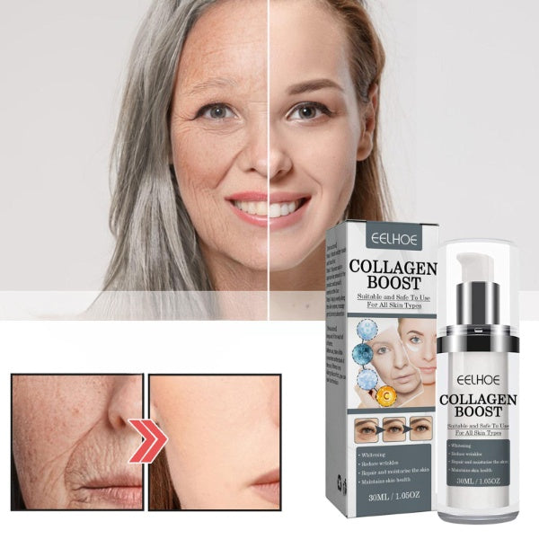 EELHOE™ - Kollagen Boost Anti-Aging-Serum (1+1 GRATIS)