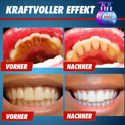 Clean Tooth™ - Zahnpasta zur intensiven Fleckenentfernung