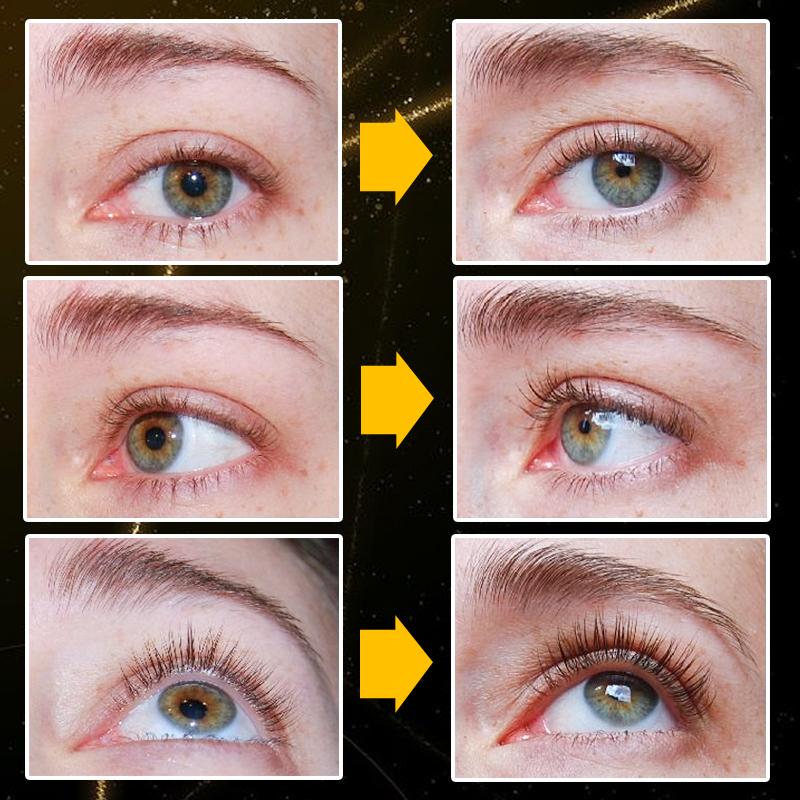 StarLash™️ I Wimpernwachstumsserum (1+1 GRATIS)