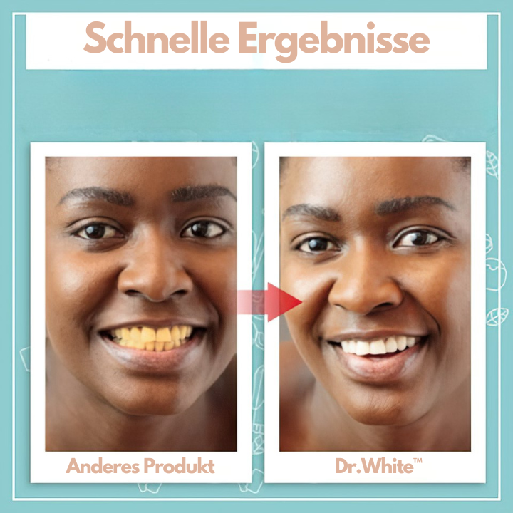 Dr.White™ - Sofort aufhellende Zahnpasta (1+1 GRATIS)