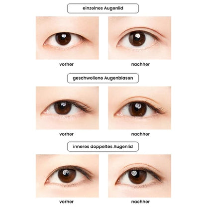 LidLine™ | Unsichtbarer doppelter Augenlidaufkleber (1+1 GRATIS)